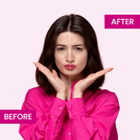 Fairness Beauty Lotion |Wrinkles, Darkspot & Acne Free Skin